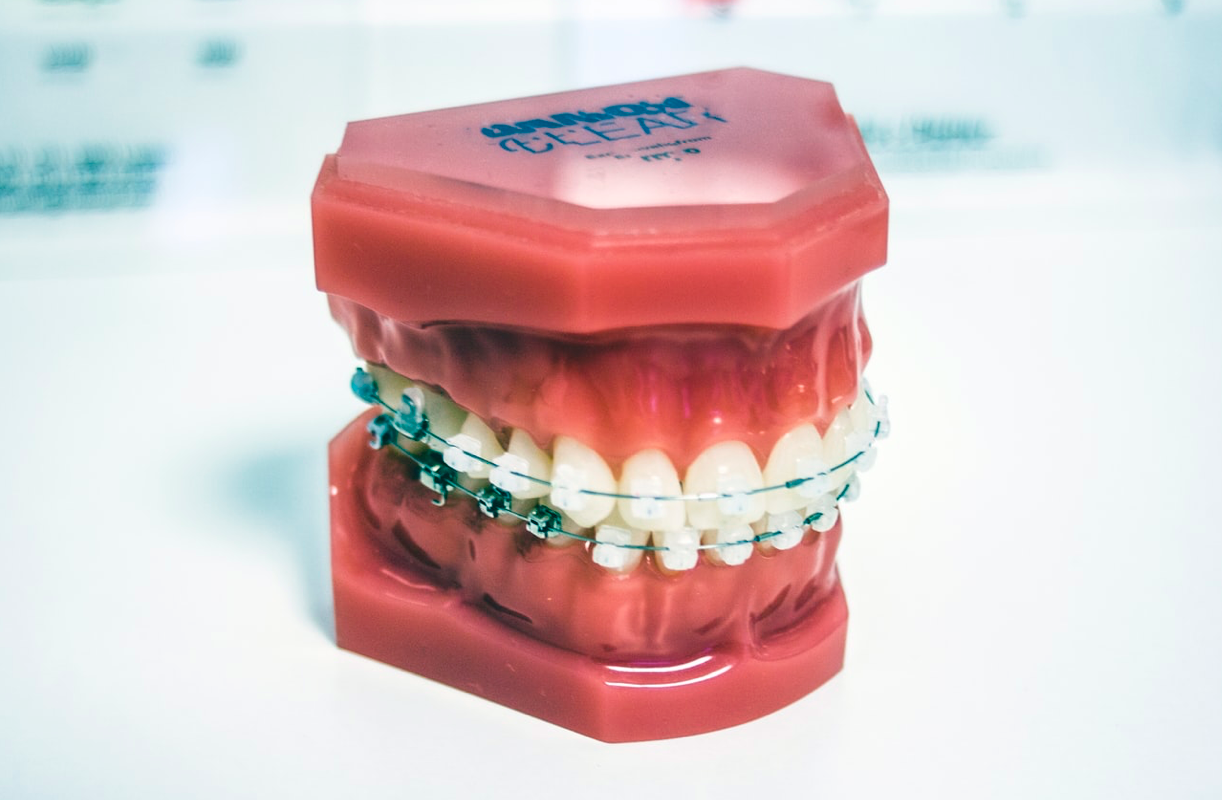 sld3 fillings